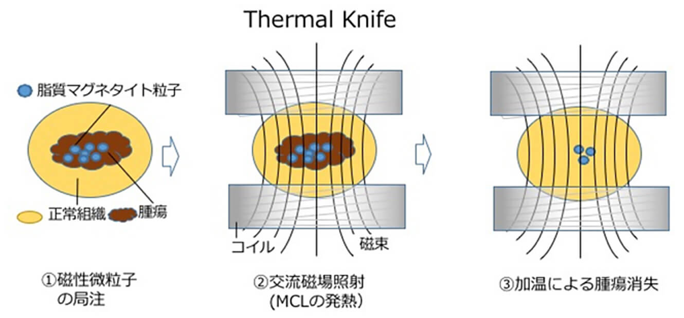 革新的がん温熱治療（ハイパーサーミア）の研究